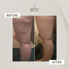 Load image into Gallery viewer, Fascia Blaster