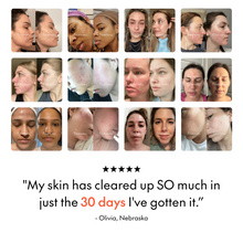 Load image into Gallery viewer, Bathroom Sink Filters: Filterbaby Skincare Filter 2.0