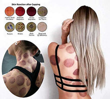 Load image into Gallery viewer, Professional Chinese Acupoint Cupping Therapy Set
