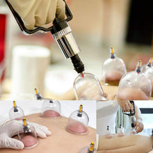 Load image into Gallery viewer, Professional Chinese Acupoint Cupping Therapy Set
