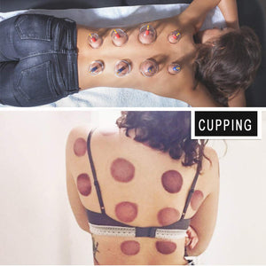 Professional Chinese Acupoint Cupping Therapy Set